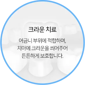 크라운 치료