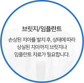 브릿지/임플란트